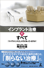 インプラント治療のすべて